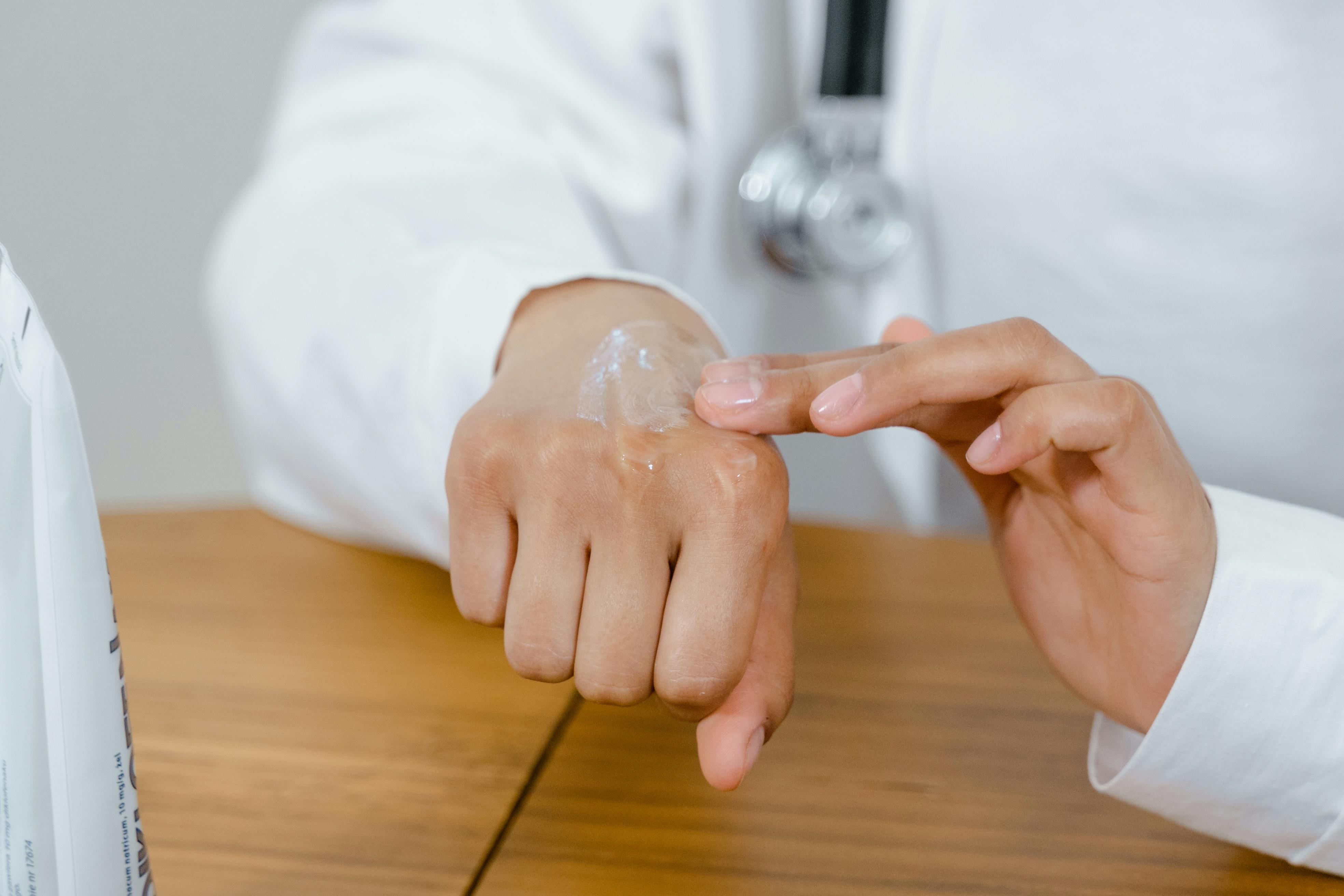 Person with dry hands applying lotion